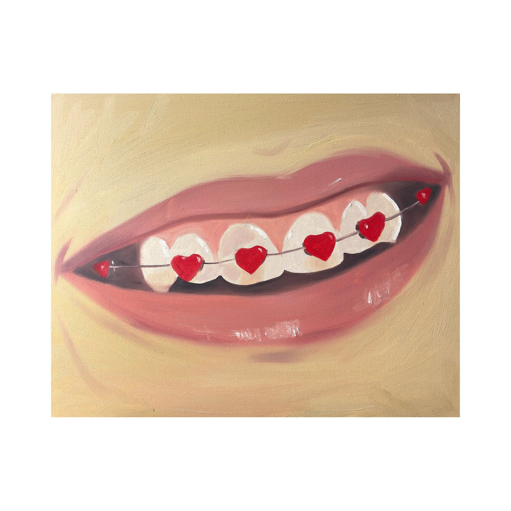 The artwork "Smile" by Anastasia Korsakova features a stylized close-up of a smiling mouth with white teeth adorned by a unique braces design consisting of red heart-shaped brackets connected by a thin wire. Soft, warm tones and smooth textures create a playful figurative composition reminiscent of Pop Art influences and the whimsical spirit found in works by Roy Lichtenstein and Keith Haring.